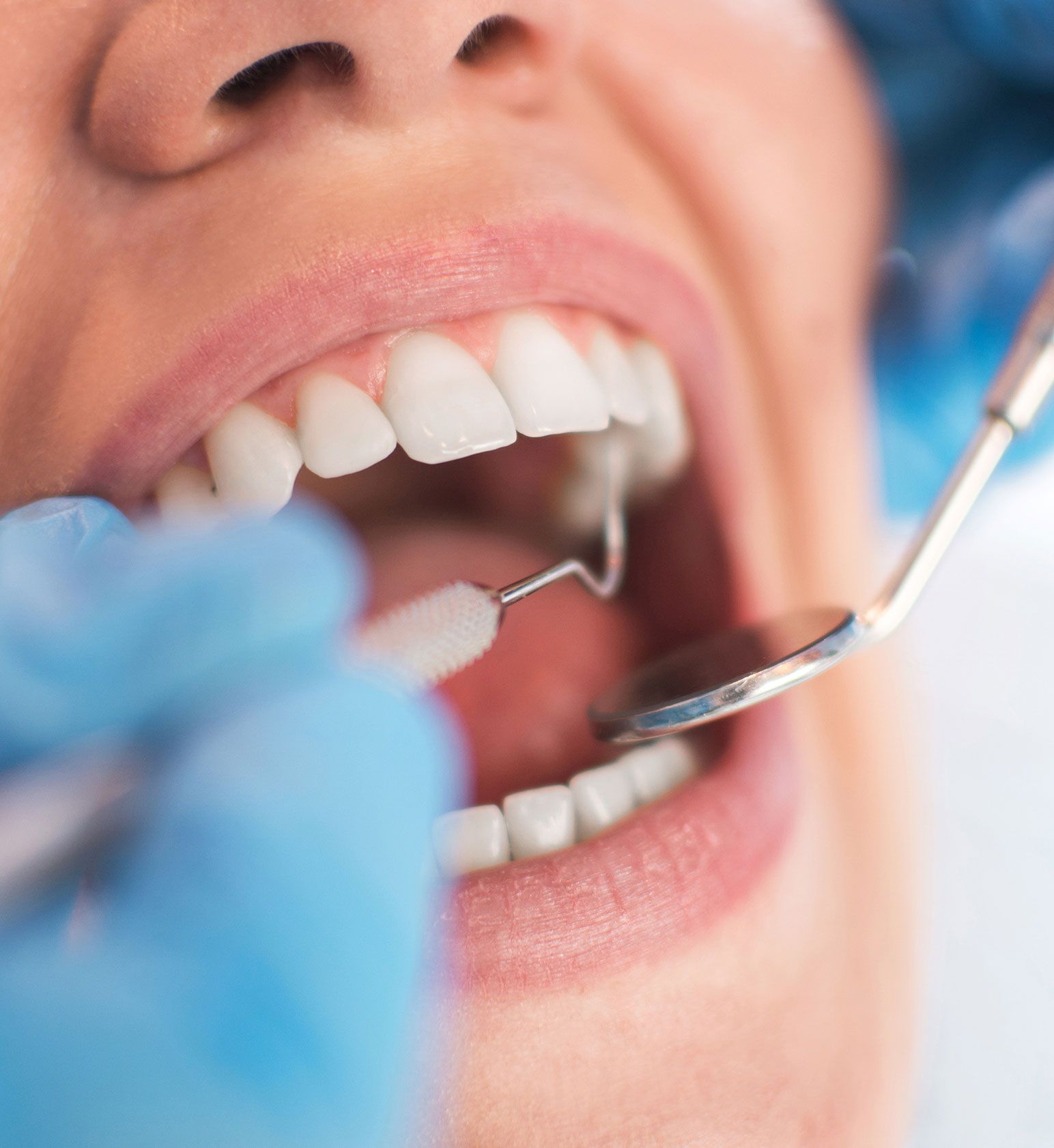 Allgemeine Zahn Untersuchung